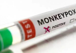 Casos de Mpox chegam a 140 no Brasil em 2026