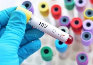SUS pode incorporar PrEP injetável contra o HIV ainda em 2026