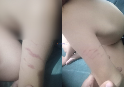 Família denuncia agressão contra criança de 5 anos dentro de Ciep em Campos Família denuncia agressão contra criança de 5 anos dentro de Ciep em Campos