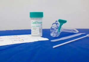 SUS detecta quase 10 mil testes positivos para HPV de alto risco